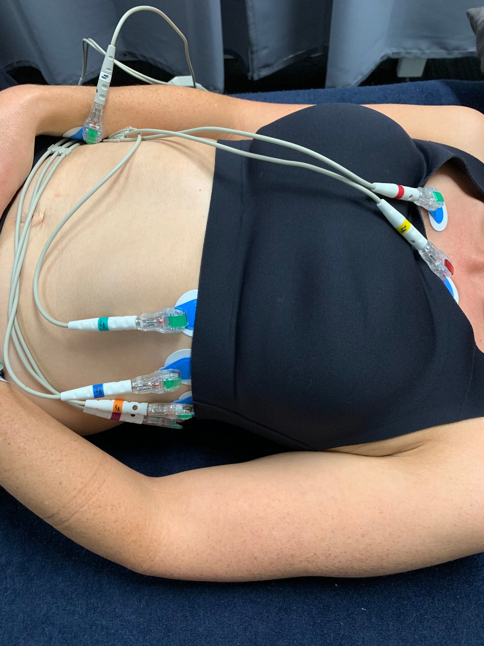 Exame de eletrocardiograma realizado por profissional de saúde, fotografia ilustrativa