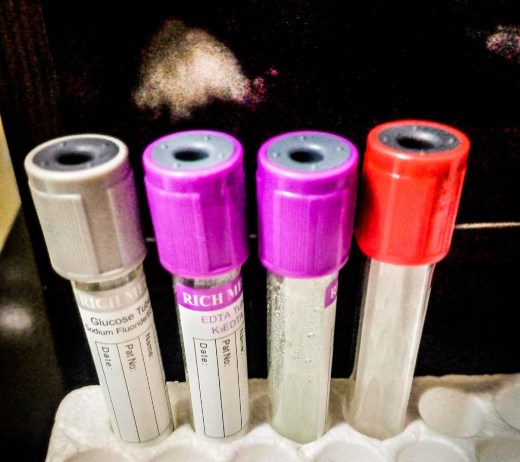 Tubos de amostras em laboratório médico, fotografia ilustrativa que não mostra a coleta de DNA-HPV em Goiás